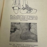 Новокаинът в съвременната терапия -В.Янчев,1963,стр.211, снимка 6 - Специализирана литература - 45304720