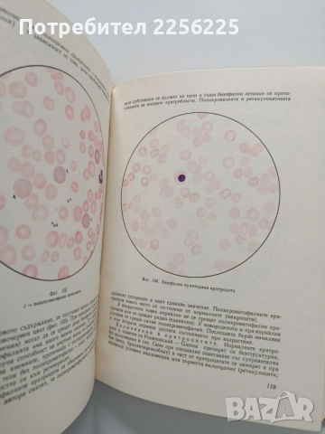 Хематологичен атлас , снимка 5 - Специализирана литература - 54030808