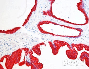 Основен фуксин 99 % прах - багрило за микроскопско наблюдение., снимка 2 - Лаборатория - 53691705