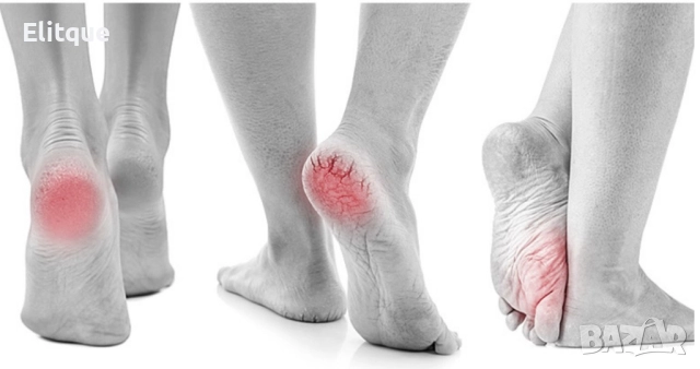 Електрически уред за премахване на мъртва кожа от петите, снимка 12 - Електрически пили за пети - 52861366