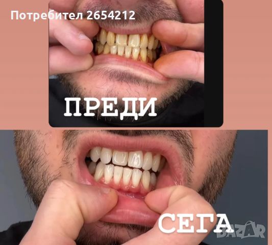 Писалка за избелване на зъби v34, снимка 1 - Медицински, стоматологични - 45234530
