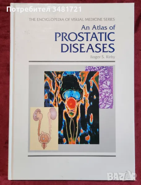 Атлас на заболяванията на простатата / An Atlas of Prostatic Diseases, снимка 1