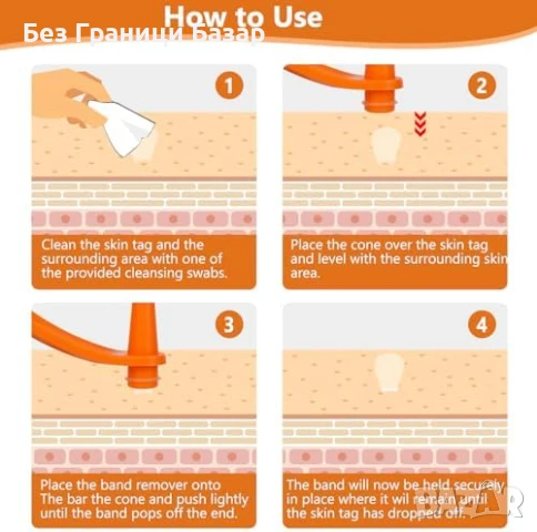 Нов Професионален комплект FLETUTE за премахване на бенки – хидроколоидни пластири, снимка 6 - Други - 51107026