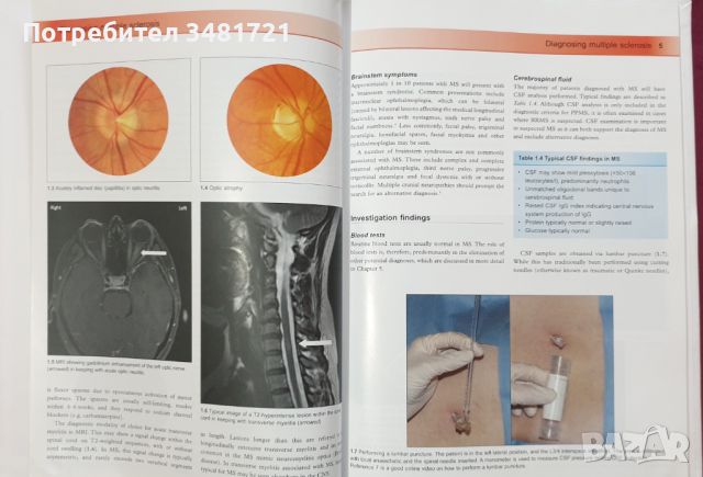 Множествена склероза - визуален справочник / Multiple Sclerosis - Visual Guide for Clinicians, снимка 4 - Специализирана литература - 45667994