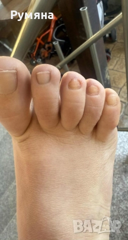 Мехлем срещу гъбички по ноктите и кожата , снимка 5 - Други - 51082505