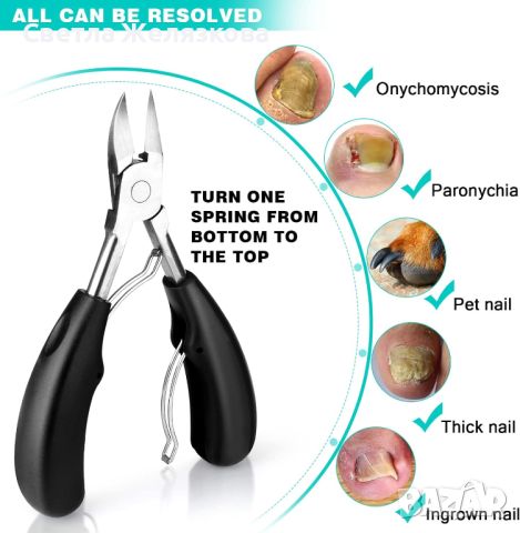 Комплект за врастнали нокти, 10 части, неръждаема стомана, снимка 8 - Други - 46056842