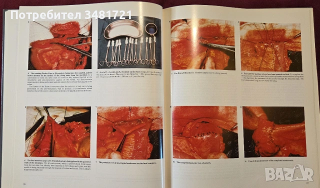 Голям атлас на колоректалната хирургия / A Colour Atlas of Colorectal Surgery, снимка 7 - Специализирана литература - 53748180