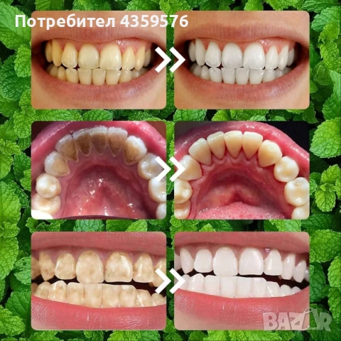 Писалка за избелване на зъби и пудра за избелване , снимка 6 - Други - 53760109