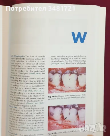 Енциклопедия на пародонтологията / Concise Encyclopedia of Periodontology, снимка 6 - Специализирана литература - 47018253