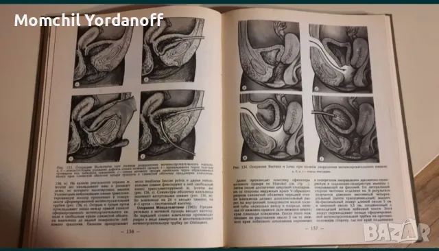 Атлас урогинекологических операций, снимка 5 - Специализирана литература - 49309384