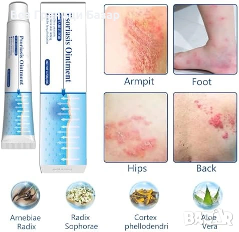 Нов Натурален крем при псориазис – без аромат, нежен към чувствителна кожа, снимка 7 - Други - 53368793