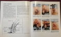 Голям атлас на колоректалната хирургия / A Colour Atlas of Colorectal Surgery, снимка 11