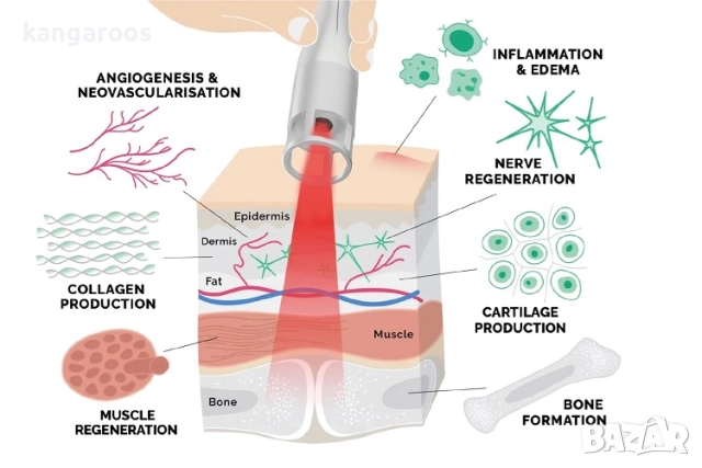 Високоинтензивен лазер AresPro HP Laser, снимка 4 - Медицинска апаратура - 51862623