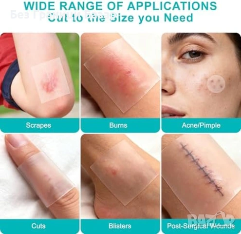 Нова Хидроколоидна превръзка за рани и изгаряния водоустойчива 5см x 1.5м, снимка 4 - Други - 53280182