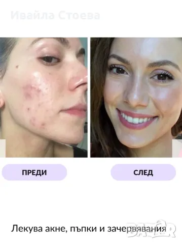 LED Маска за лице - Lumina Glow, снимка 5 - Козметични уреди - 50280678