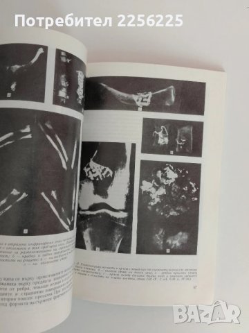 Калояновото погребение, снимка 5 - Специализирана литература - 51089524