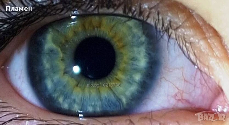 Ирисова диагностика, снимка 1