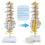 Модел на лумбалната част на гръбначния стълб в реален размер с 5 прешлена, анатомичен модел, снимка 7