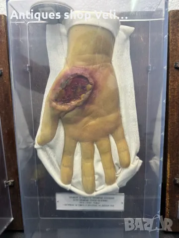 УНИКАЛНО Восъчни Ръчно Изработени Анатомични Мулажи КОЛЕКЦИЯ №69340 , снимка 7 - Антикварни и старинни предмети - 50402170