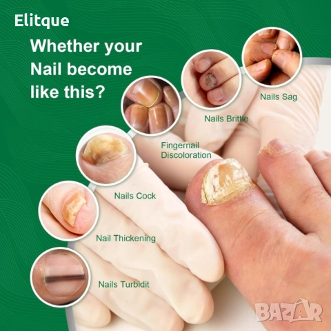 Спрей за възстановяване на увредени нокти 10ml, снимка 11 - Други - 52901546