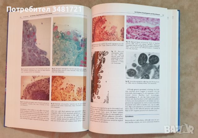 Учебник-атлас по чревни инфекции при СПИН / Textbook-Atlas of Intestinal Infections in AIDS, снимка 5 - Специализирана литература - 46497175