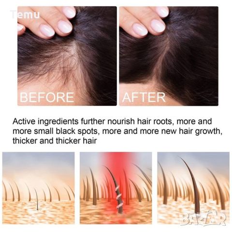 Многофункционален продукт за коса – растеж, заздравяване и сгъстяване, снимка 11 - Продукти за коса - 45792555