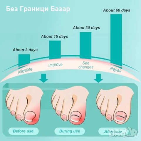 Нов Комплект за корекция на врастнали нокти 9 броя 3 размера лечение, снимка 2 - Други - 51581019