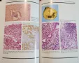 Атлас на заболяванията на простатата / An Atlas of Prostatic Diseases, снимка 8