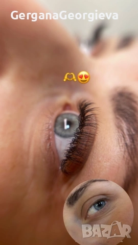 Миглопластика/удължаване на мигли