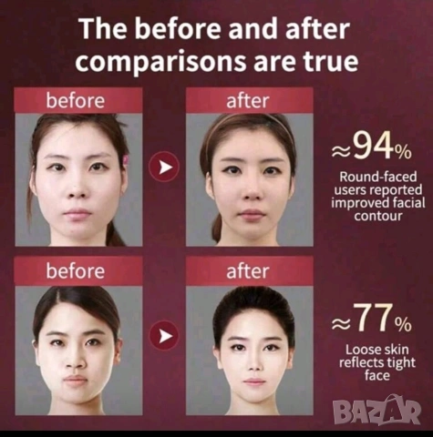 V-образен вибромасажор за двойна брадичка + Подарък, снимка 3 - Масажори - 53434632