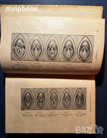 Стара Книга Ръководство по Половия Въпрос Д-р Вандер 1946 г., снимка 7 - Специализирана литература - 49529349