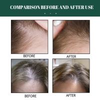 Многофункционален продукт за коса – растеж, заздравяване и сгъстяване, снимка 6 - Продукти за коса - 45686281