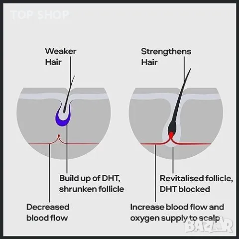 Нов Комплект за Растеж на Коса с Minoxidil DHT Шампоан Дермаролер за мъже, снимка 9 - Продукти за коса - 49309119