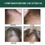 Многофункционален продукт за коса – растеж, заздравяване и сгъстяване, снимка 16