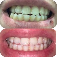 Паста за избелване на зъбите Extra white pro, снимка 2 - Други - 45170763