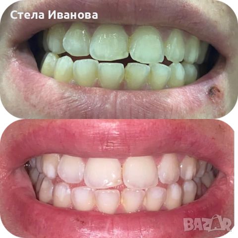 Паста за избелване на зъбите Extra white pro, снимка 2 - Други - 45170763