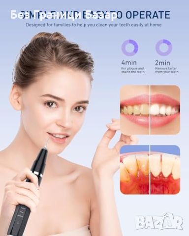 Нов уред премахва плака петна почистване зъби зъбен камък Грижа уста, снимка 5 - Други - 45962981