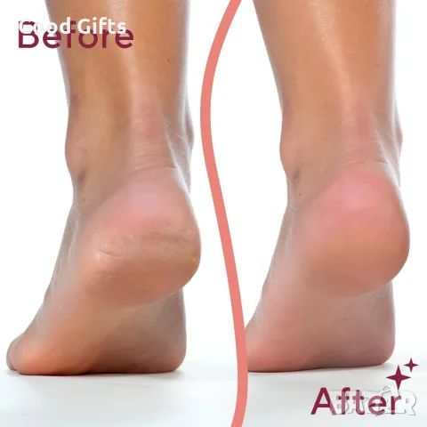 Професионална Електрическа безжична пила за пети, снимка 7 - Други - 50383973