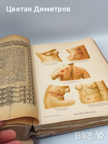 Антикварна находка Книга от 1921 г. - Жената като семеен лекар, снимка 7 - Антикварни и старинни предмети - 52856786