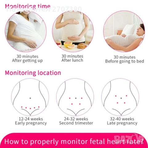 Фетален доплер, снимка 2 - Други - 51466824