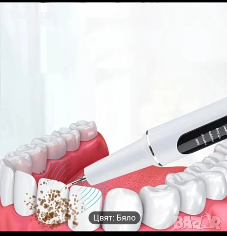 Машинка за почистване зъбен камък с ултразвук, снимка 11 - Други - 51982486