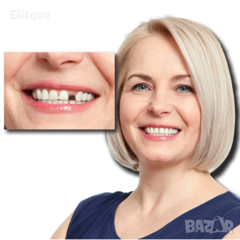 Instant Smile Lowers усмивка за минути  , снимка 3 - Други стоки за дома - 52906089