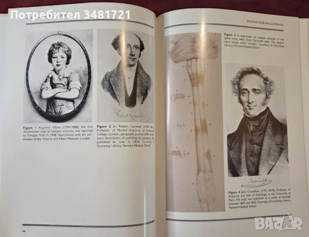 Голям атлас на множествената склероза / An Atlas of Multiple Sclerosis, снимка 6 - Специализирана литература - 53748194