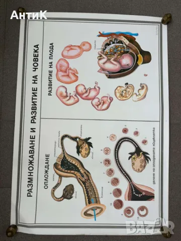 Комплект Соц Учебни Медицински Плакати, снимка 3 - Антикварни и старинни предмети - 49942165