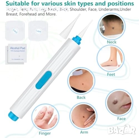 Нов Прецизен комплект за премахване на брадавици – безболезнен ефект, снимка 6 - Други - 52656175