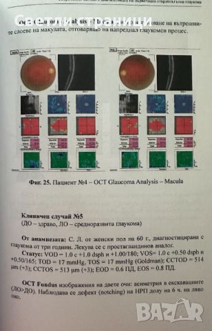 съвременни методи в диагностиката на първичната откритоъгълна глаукома, снимка 3 - Специализирана литература - 46550822