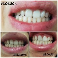 Паста за избелване на зъбите Extra white pro, снимка 4 - Други - 45170763