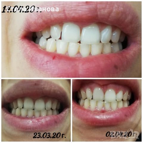 Паста за избелване на зъбите Extra white pro, снимка 4 - Други - 45170763