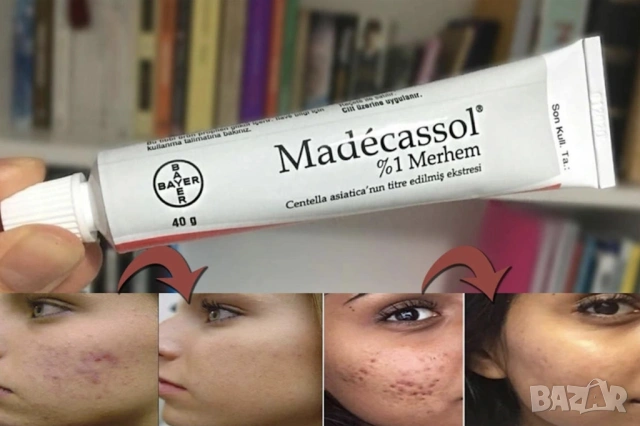 MADECASSOL / МАДЕКАСОЛ КРЕМ ПРОТИВ БЕЛЕЗИ, РАНИ , ИЗГАРЯНИЯ И АКНЕ 40gr., снимка 3 - Други - 54208093