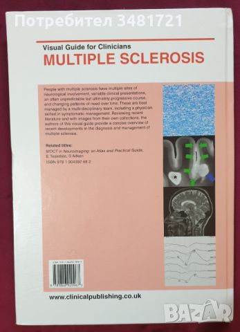 Множествена склероза - визуален справочник / Multiple Sclerosis - Visual Guide for Clinicians, снимка 13 - Специализирана литература - 45667994